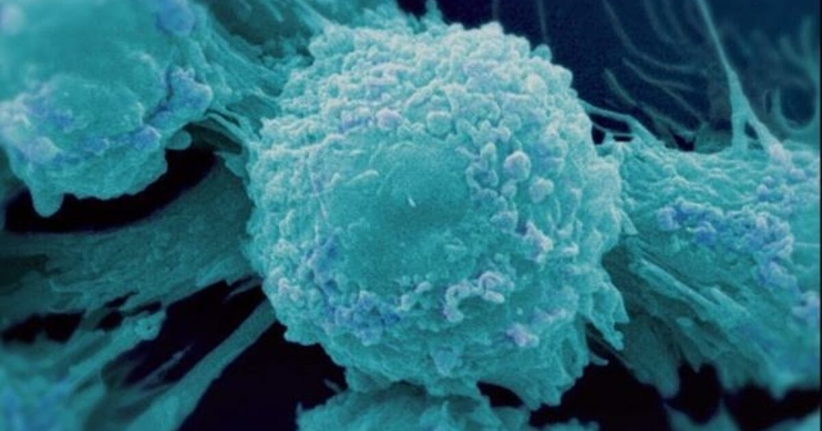 Cancer The Emperor Of All Maladies Ken Burns Pbs