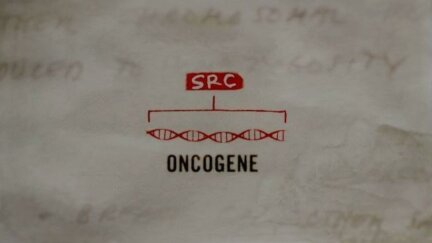 The Discovery of the Human Oncogene