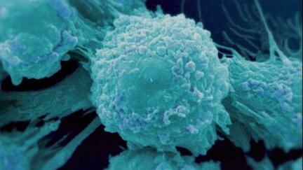 Why Cancer is so difficult to cure